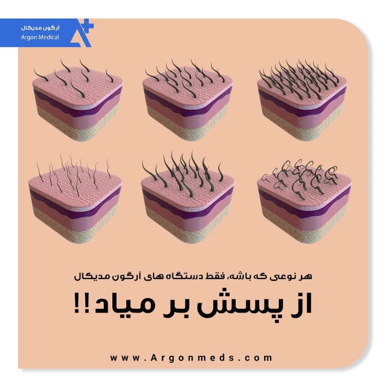 تفاوت دستگاه تیتانیوم آرگون مدیکال
