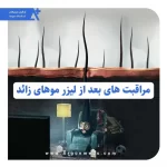 مراقبت های بعد از لیزر موهای زائد - آرگون مدیکال