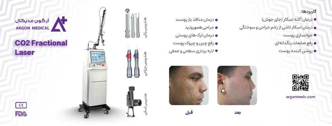 کاربردهای دستگاه لیزر فرکشنال-co2-fractional